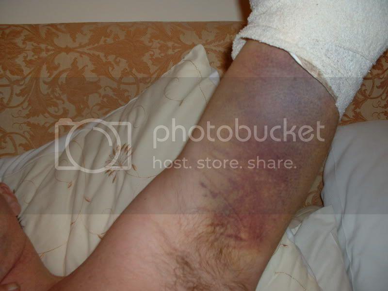 elbow015.jpg